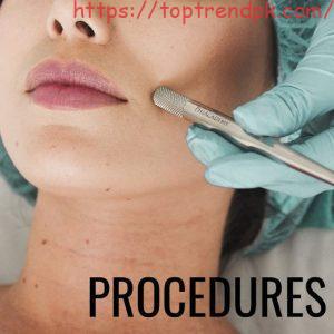 Easy way how to remove  dark patches on skin [12 Easy Tips]