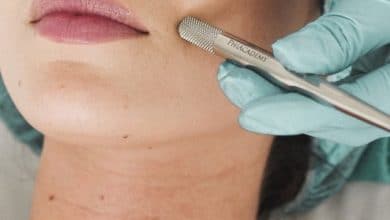Easy way how to remove dark patches on skin 