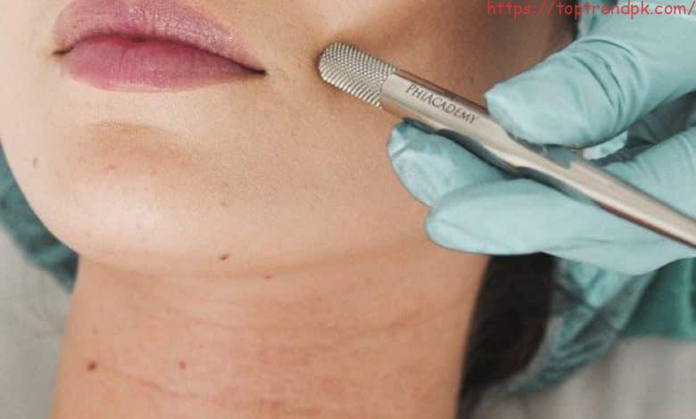Easy way how to remove dark patches on skin